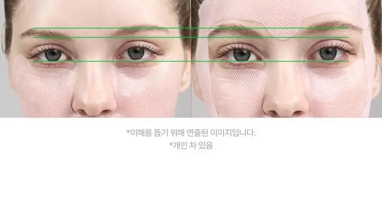 [붓기/리프팅/쿨링] 메디테라피 텐션 업 마스크 (5매입/1매입) 상세페이지 62
